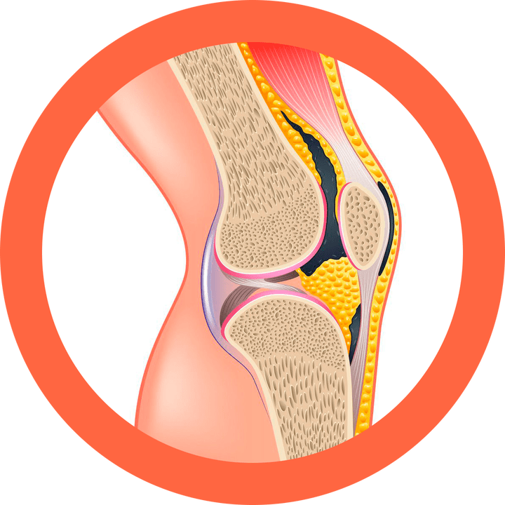 Hondroten – stellt Gelenke und Muskeln wieder her