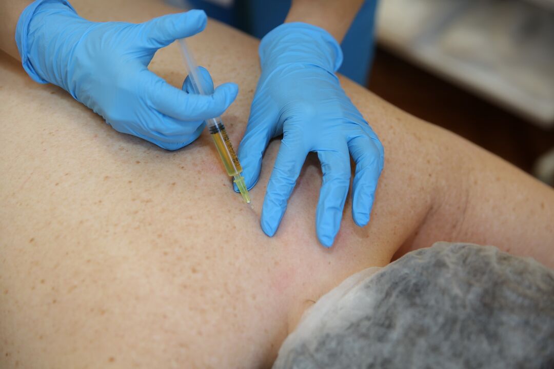 Injektionen von Chondroprotektoren für den Rücken